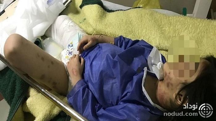 شکنجه دختر 6 ساله مهابادی با آب داغ و ضرب و شتم شدید او ! + عکس 12+