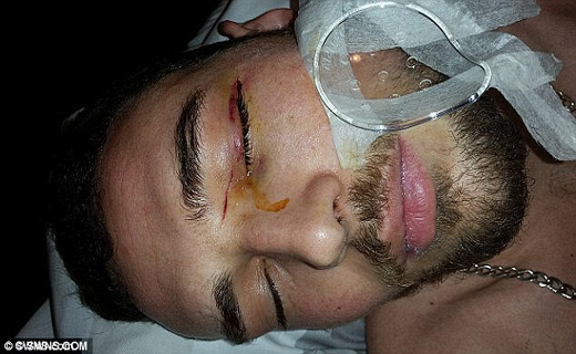 هدیه تولد چشم کودک را کور کرد+ تصاویر