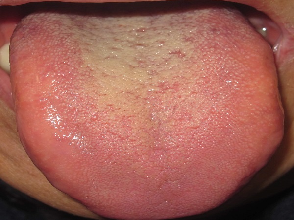 آنچه زبان درباره سلامت شما می گوید!