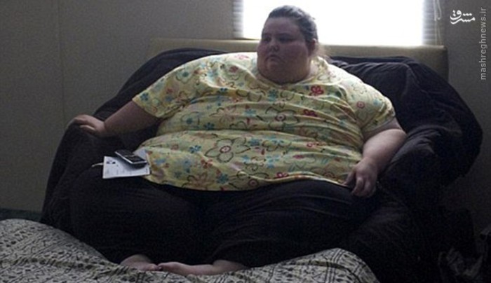 دختر 321 کیلوگرمی بعد از عمل/ عکس