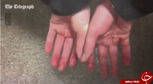 روش وحشتناک مجرم تحت تعقیب برای جلوگیری از شناسایی هویت+تصاویر