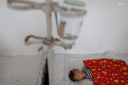 یک کودک دچار سوء تغذیه در بیمارستان 