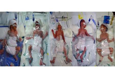 تولد پنج قلوها در قم +عکس