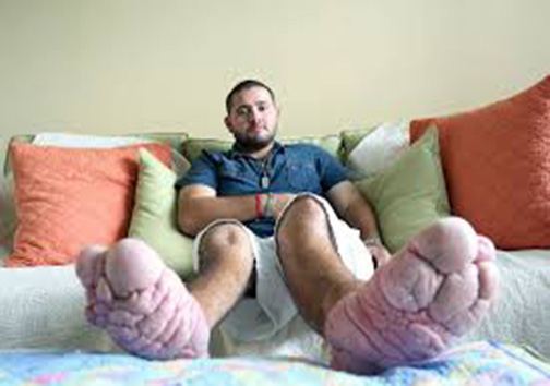 این مرد جوان عاجزانه خواستار قطع کردن پاهایش است + تصاویر