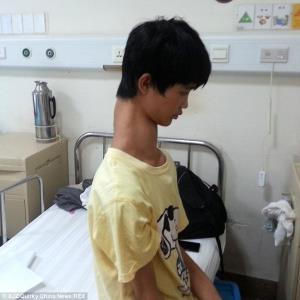 نوجوان چینی با گردن دراز+عكس