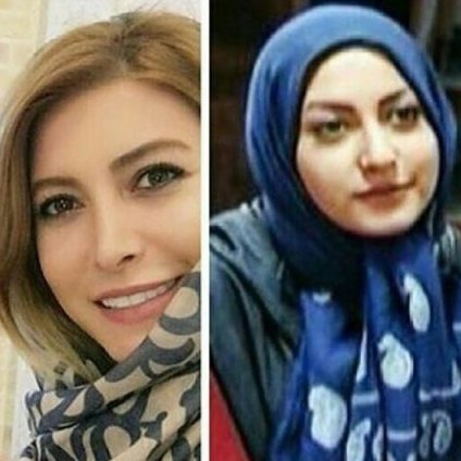 فریبا نادری قبل و بعد از جراحی زیبایی بینی