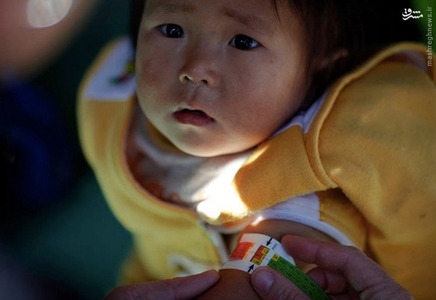 معاینه کودک مشکوک به سوء تغذیه 