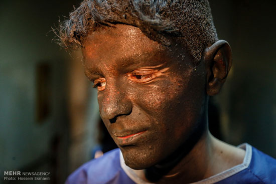 عکس: مصدومان چهارشنبه سوری در تهران