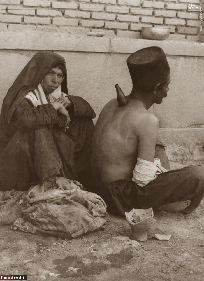 حجامت در دوره قاجار/عکس