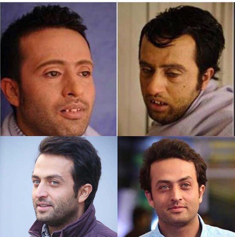 گریم متفاوت مصطفی زمانی در فیلم پریناز!