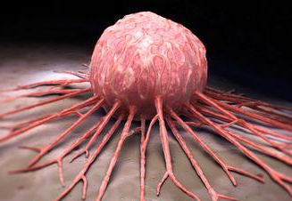 Ø±Ú˜ÛŒÙ…ÛŒ ØºØ°Ø§ÛŒÛŒ Ø¨Ø±Ø§ÛŒ Ù¾ÛŒØ´Ú¯ÛŒØ±ÛŒ Ø§Ø² Ø³Ø±Ø·Ø§Ù† Ø³ÛŒÙ†Ù‡