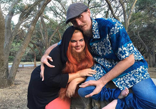 ازدواج مرد خرچنگی و زن ریش‌دار + تصاویر