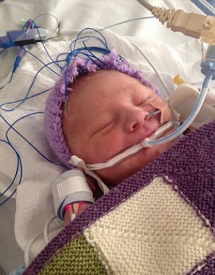 نوزادی که مُرد و زنده شد/ عکس