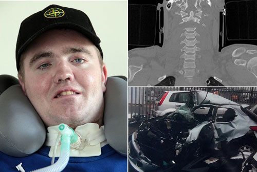 بازگشت به زندگی مردی که سرش قطع شد!/عکس