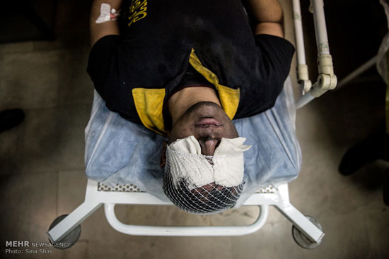 عکس: مصدومان چهارشنبه سوری در تهران